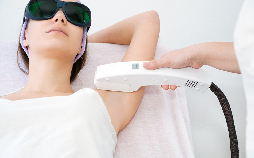 Why now is the time to get laser hair removal