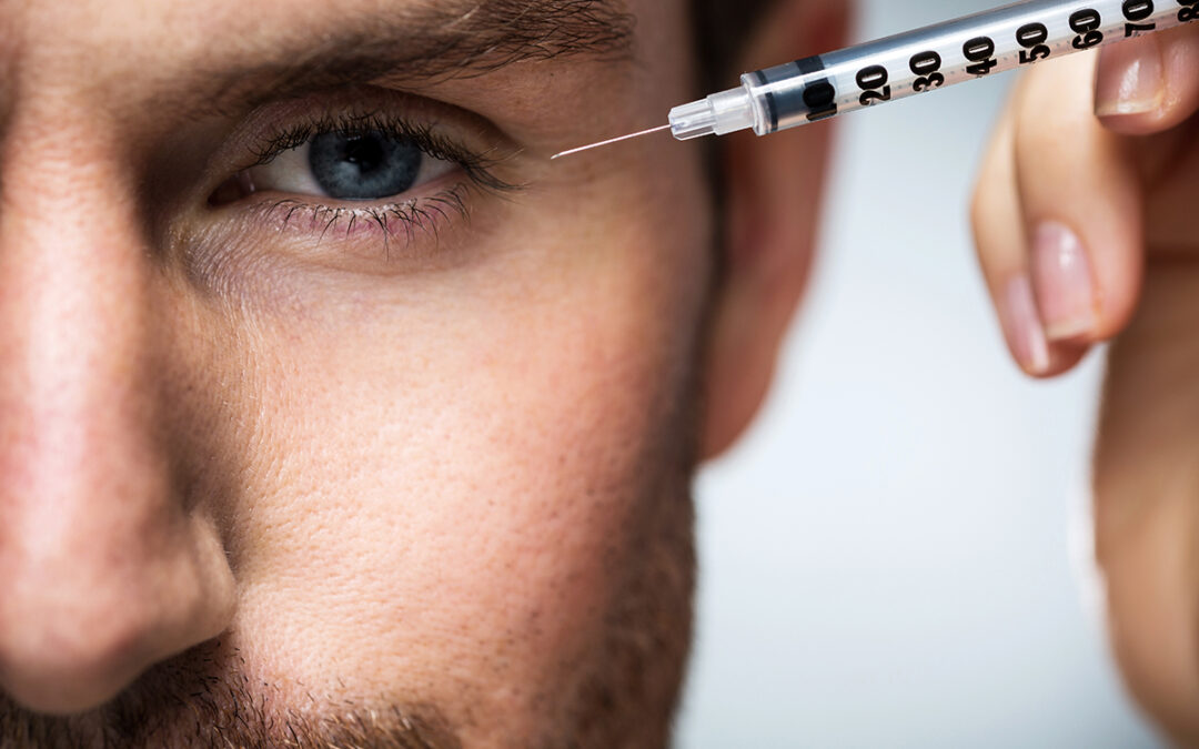 Considering Botox? Here are some things you should know