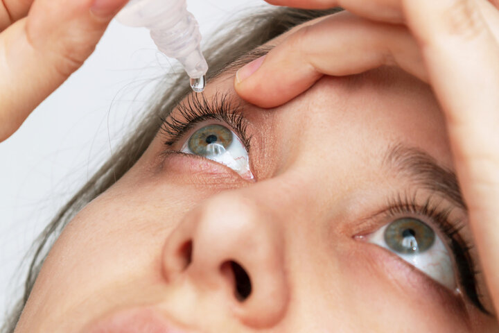 Dry eye treament in Bellevue, WA